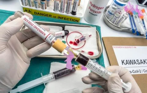 Nurse draws blood sample to treat Sars-CoV-2-related Kawasaki disease in chil Stock Photos