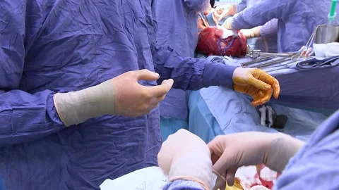 Nurse helping surgeon put on gloves in operating room. Close-up Stock Footage 147596364