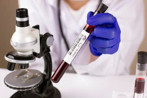 Nurse holding a tube with blood test result for coronavirus Stock Photos