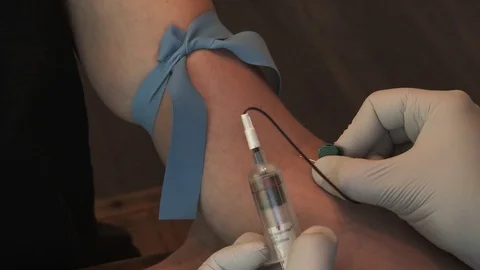 Nurse Inserts Needle For Blood Sample Stock Footage 78016288