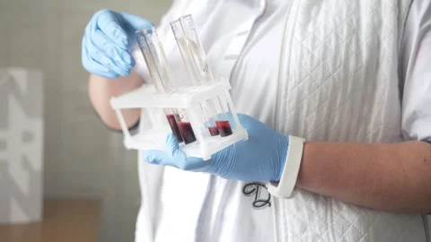 The nurse inserts the tube Video stock 241433579