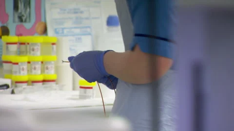 Nurse Preparing Endoscopy Camera Vídeos de archivo 146284617