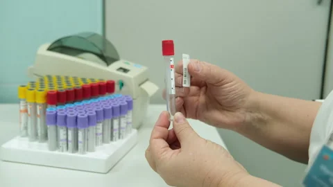 A nurse puts a barcode on a blood test tube. Stock Footage 249665074