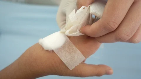The nurse remove the saline lock from kid's hand in the hospital Stockbeeldmateriaal 101930672