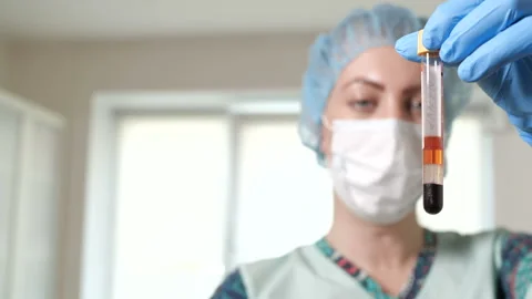 Nurse is shaking the blood sample Video stock 91626168