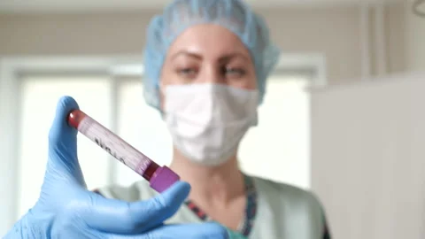 Nurse is shaking the blood sample Stock Footage 92053546