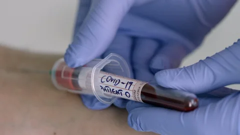 Nurse Taking Blood Sample from Suspected COVID-19 Patient Zero - Part 3 Stock Footage 129822707