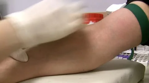 Nurse taking blood sample for a test Stock-Footage 12721421