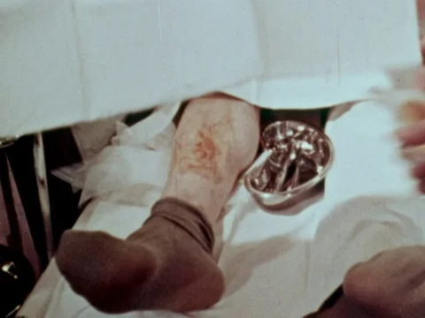 Nurses getting ready for a procedure, Scotland, United kingdom, uk, 1948 Stock Footage 134035978