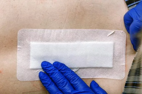 The nurse's hands are patching the postoperative seam with a plaster. Standar Stock Photos