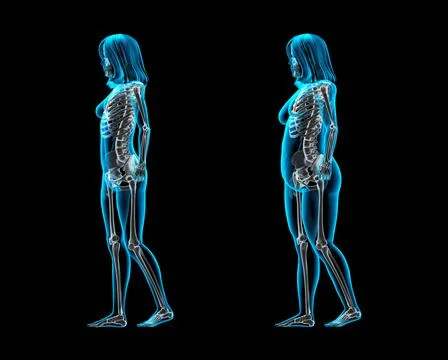 Obese and thin women posing in catwalk style, X-ray image Stock Illustration