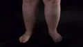 Obese male legs turning around dark background, body care, unhealthy nutrition HD Footage