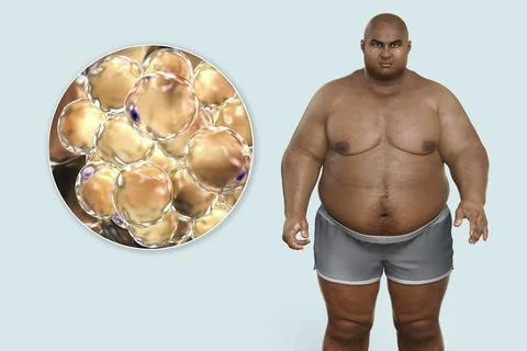 Obese man and close-up view of fat cells, 3D illustration. Concept of obesity Stockillustratie