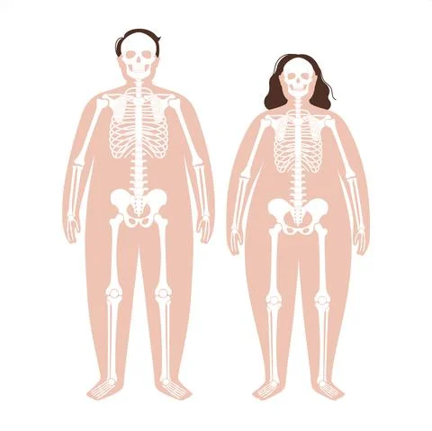 Obese skeleton anatomy Illustrazione stock