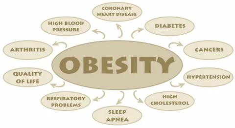 Obesity Stock-Illustration
