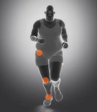 Obesity joint problem concept Stock Illustration