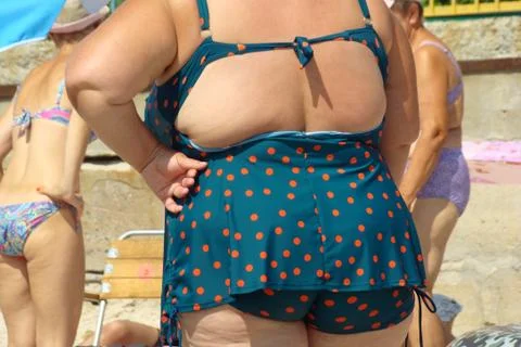 Obesity Stock Photos