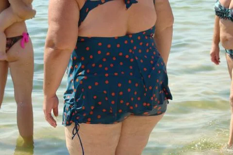 Obesity Stock Photos