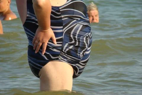 Obesity Foto stock