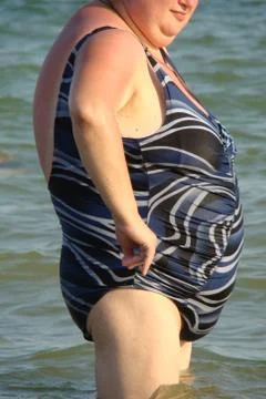 Obesity Stock Photos