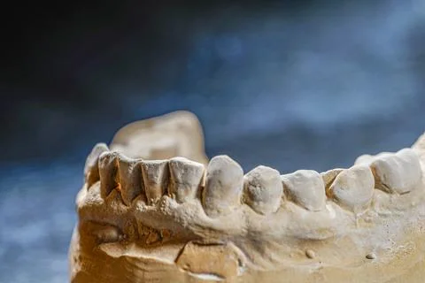 Object image of a dental impression Stock Photos
