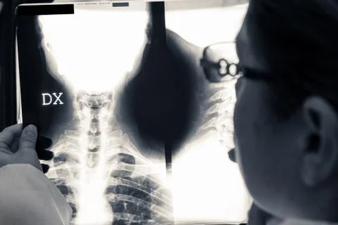 Observe the x-ray Stock Photos