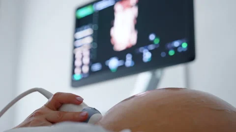 Obstetrician's hand  Stock Footage 252101926