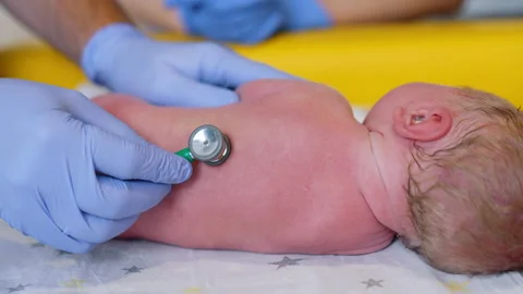 Obstetrician's hands in gloves using stethoscope to examine newborn Stock Footage 248566883
