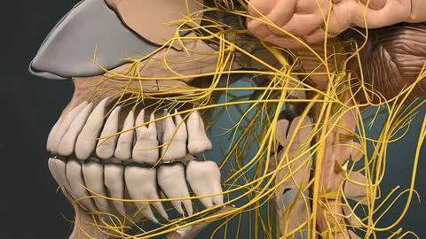 Obstruction of the vessels of the brain Stock Illustration