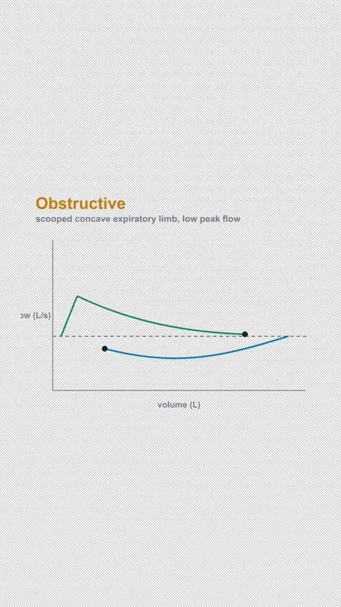 Obstructive Labeled Spirometry Flow Volume Loop Alpha 4K Vertical 9x16 Light Видео 339508100