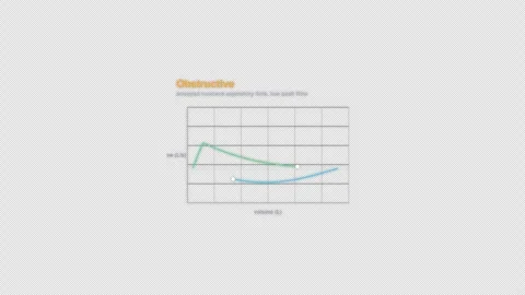 Obstructive Spirometry Flow Volume Loop Animation Labeled Video Overlay Alpha 4K Stockbeeldmateriaal 339302301