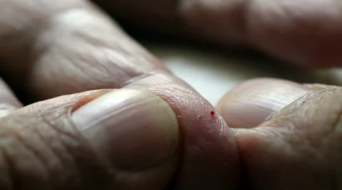 Obtaining blood test Stock Footage 68299738