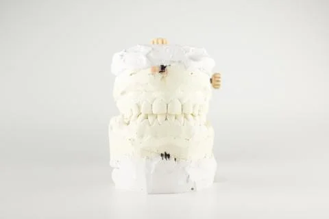 Occludator with plastered dentition models Stock Photos