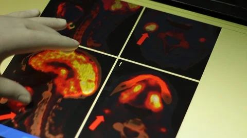 ODESA, UKRAINE - 1/10/2019: Analyze of Brain and Neck on Touch Screen Display. Stock Footage 100598896