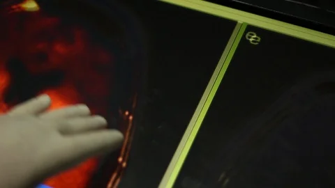 ODESA, UKRAINE - 1/10/2019: Analyzing of Brain Image on Touch Screen Display. Stock Footage 100599018