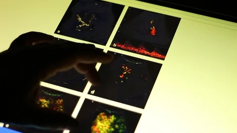 ODESA, UKRAINE - 1/10/2019: Analyzing of Liver on Touch Screen Display. Stock Footage 100599987