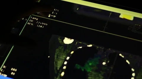 ODESA, UKRAINE - 1/10/2019: Analyzing of Spinal Cord on Touch Screen Display. Stock Footage 100600051