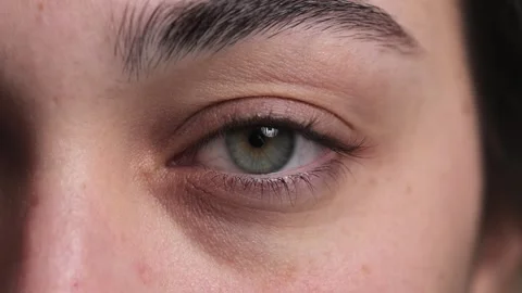 Oko trep 1 Video stock 329624691