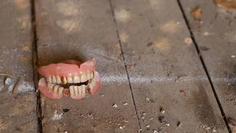 Old dirty denture Stock Footage 88919036