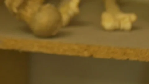 Old Human Skull Teeth Stock Footage 93460600