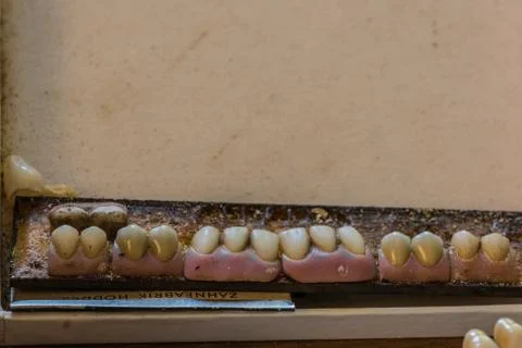 Old implants and teeth in a house from a dental technician Stock Photos