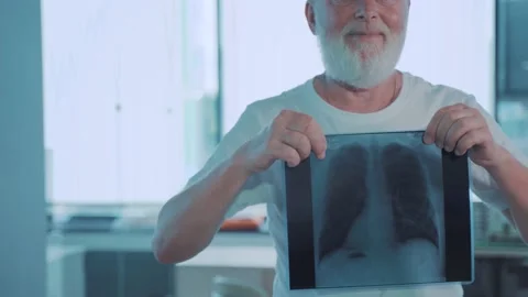 Old  man and lung x-ray Video stock 158667879