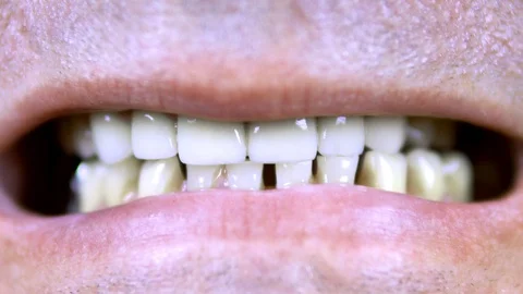 Old man shows teeth. The upper teeth are straight and the lower crooked. close Stock Footage 115214466