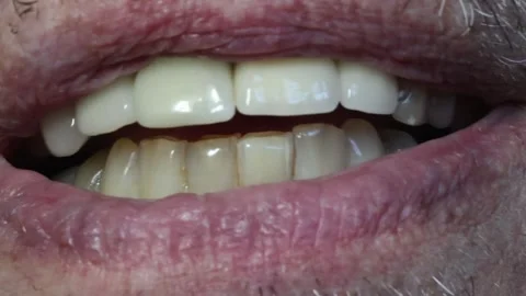 Old man is smile and show his Teeth Stock Footage 328112416
