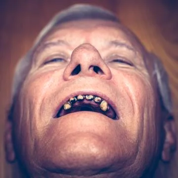 Old man with ugly teeth Stock Photos
