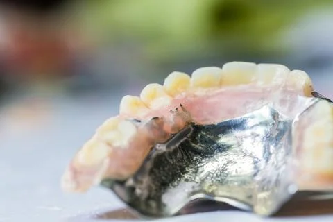 Old partial denture Stock Photos