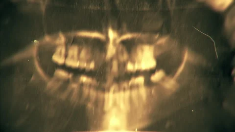 Old projector displaying green Xray Bones scan images. X ray device animation. 動画素材 295881743