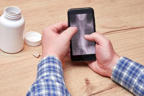 An old sick man checking a CT scan of his lungs on the cell phone screen Stock Photos