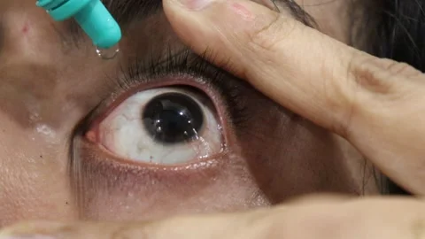 Old woman using eye drops, closeup view, woman using medical eyes drops Stock Footage 247428255