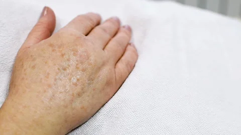 Old women's hands with pigmentation close-up Stock Footage 100471475